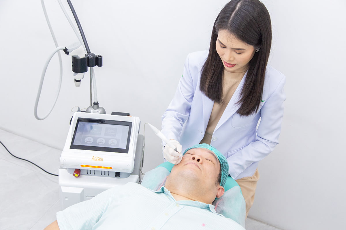 รักษาสิวด้วย Acgen