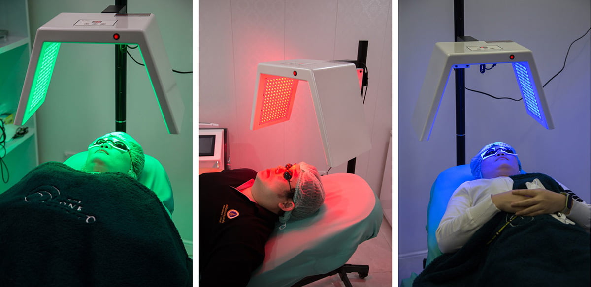 รักษาสิวด้วย PDT