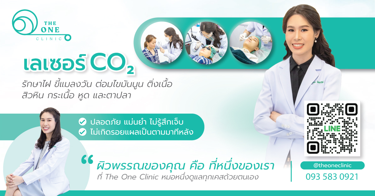 บริการเลเซอร์ไฝ