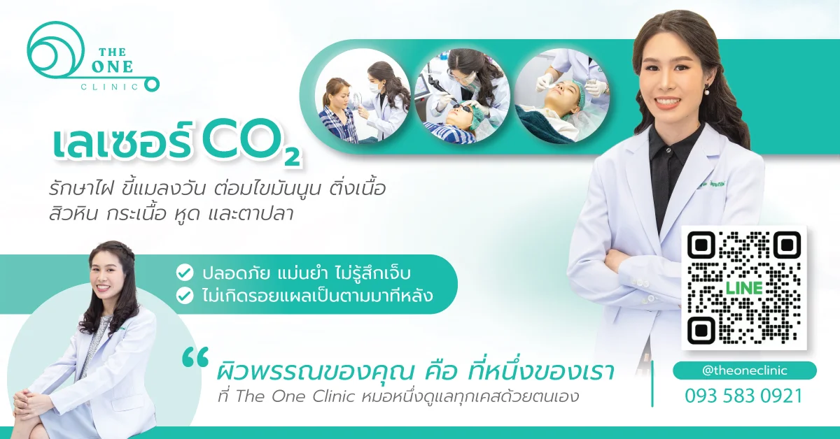บริการเลเซอร์ไฝ