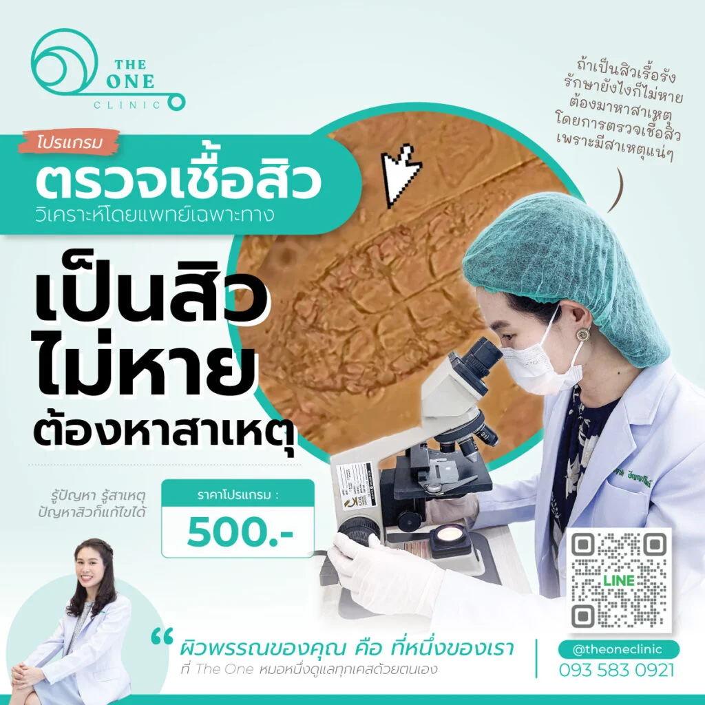 ตรวจเชื้อสิวครั้งละ 500 บาท