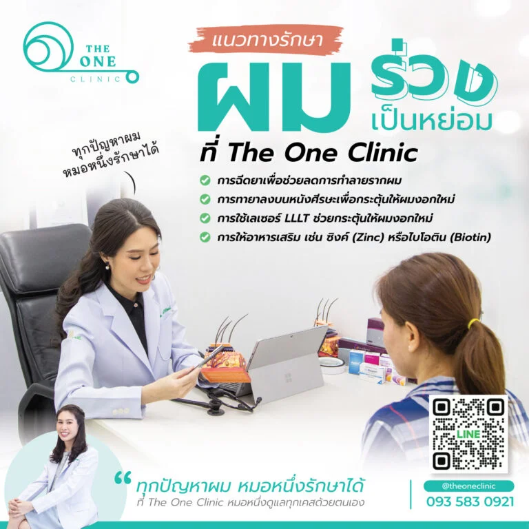 การรักษาผมร่วงเป็นหย่อม