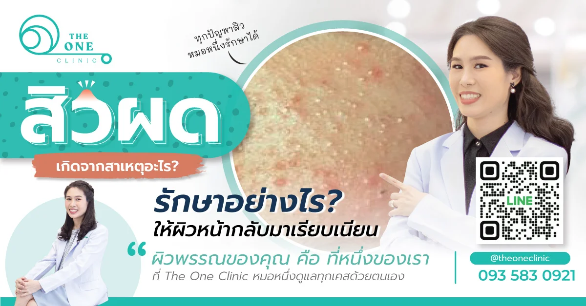 สาเหตุการเกิดสิวผด