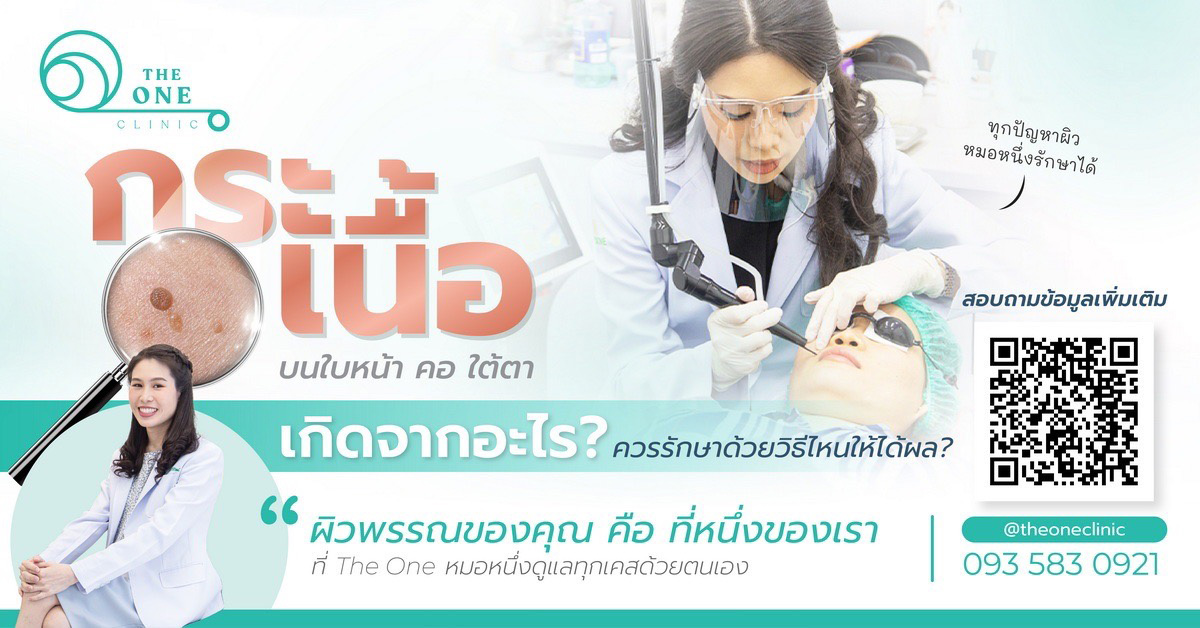 กระเนื้อเกิดจากอะไร