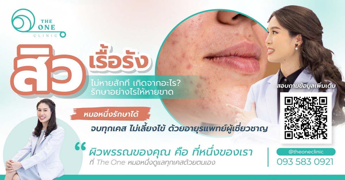 สิวเรื้อรังเกิดจากอะไร รักษาอย่างไร