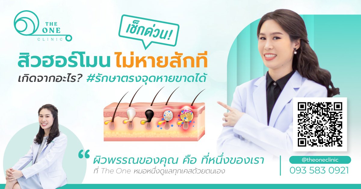 สิวฮอร์โมนไม่หายสักที เกิดจากอะไร