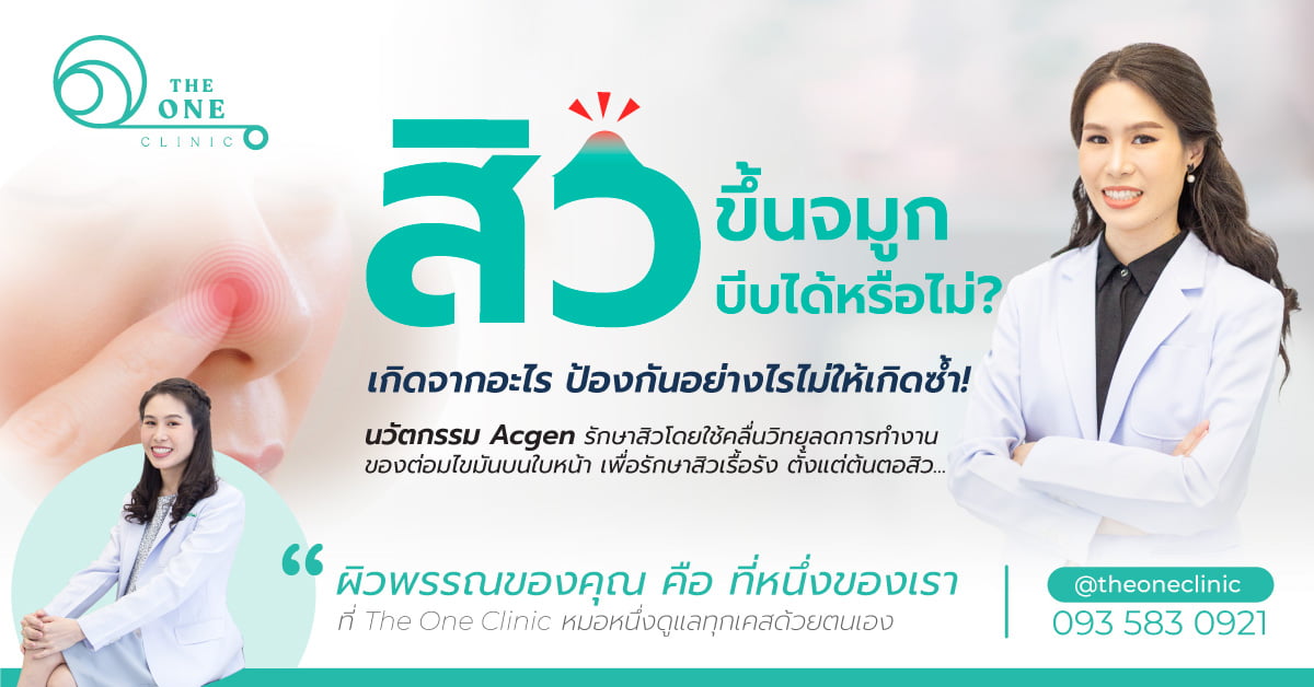 สิวขึ้นจมูกบีบได้หรือไม่