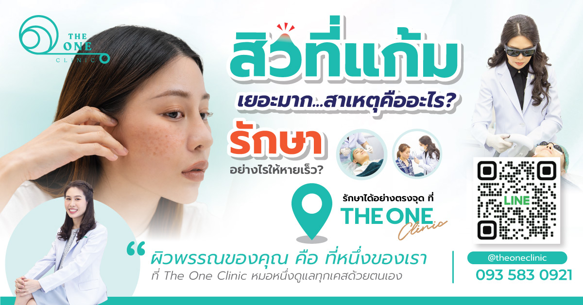 สิวที่แก้มสาเหตุคืออะไร