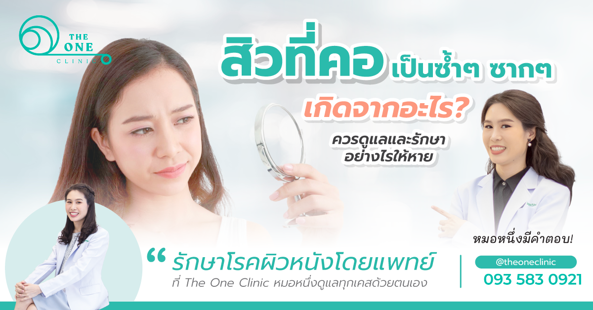 สิวที่คอ