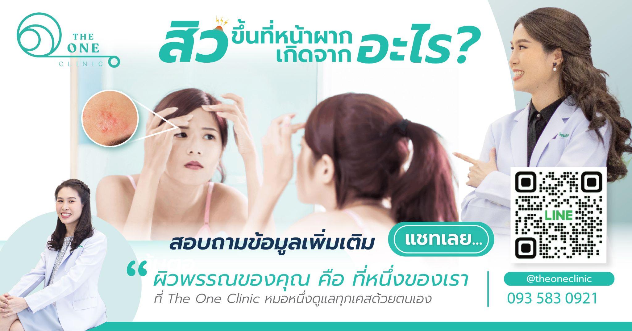 สิวที่หน้าผาก