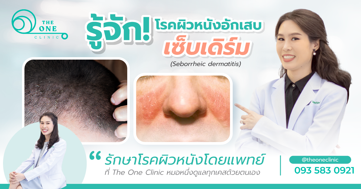 เซ็บเดิร์ม
