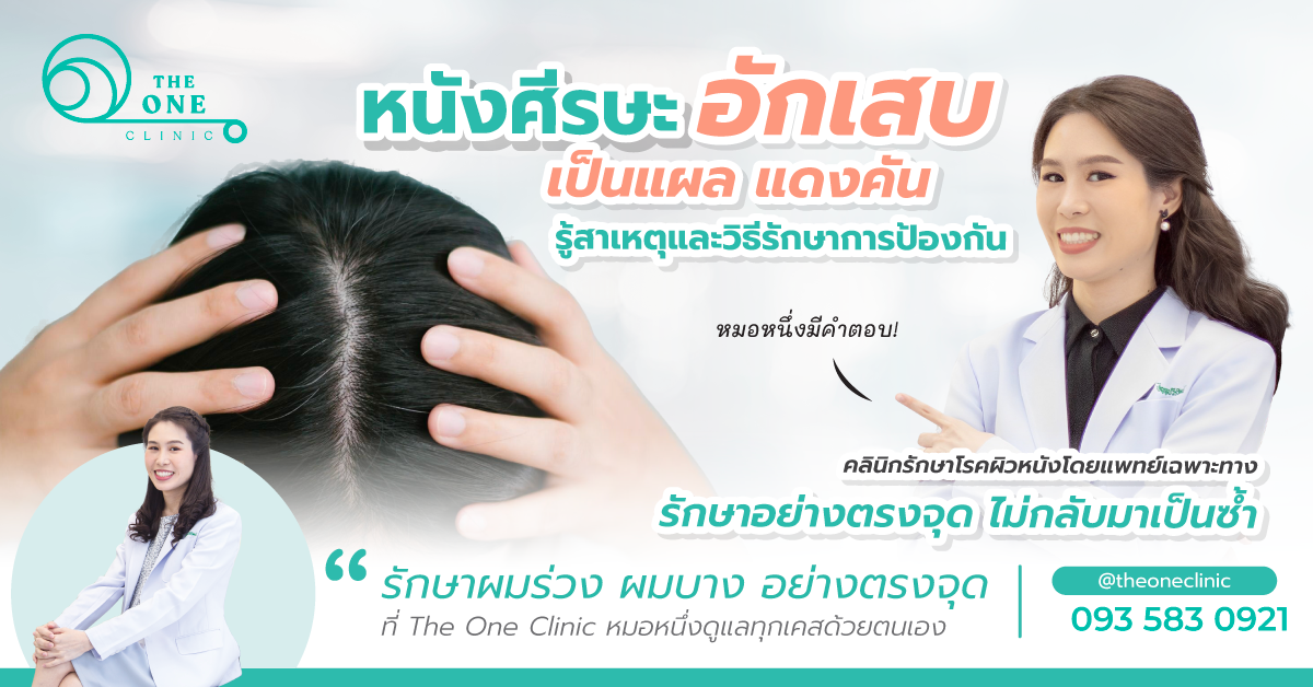 หนังศีรษะอักเสบ