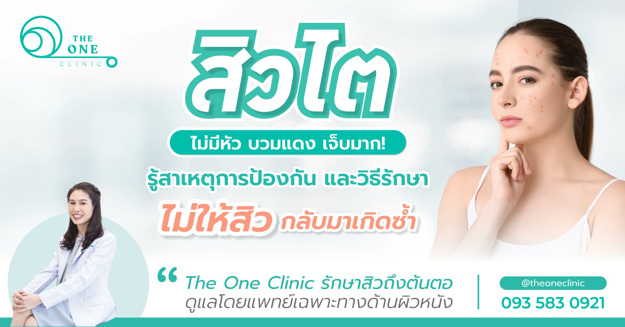 สิวไต