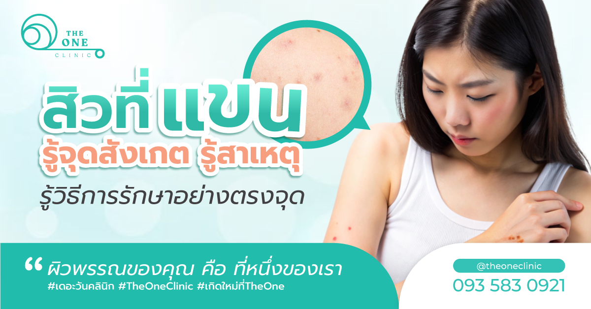 สิวที่แขน