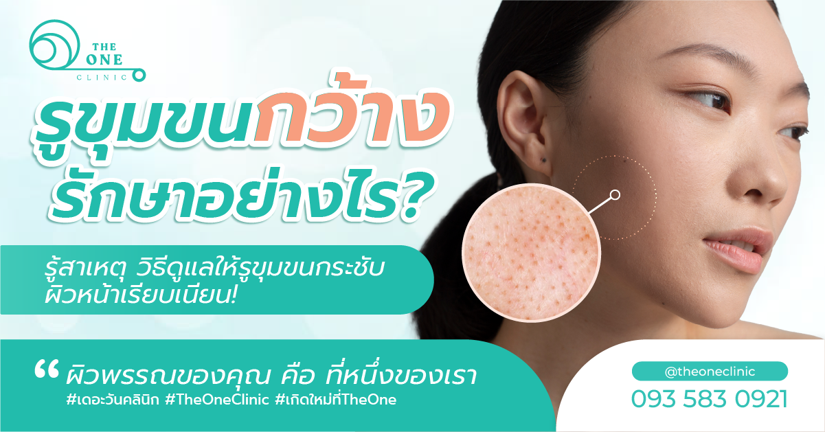 รูขุมขนกว้าง