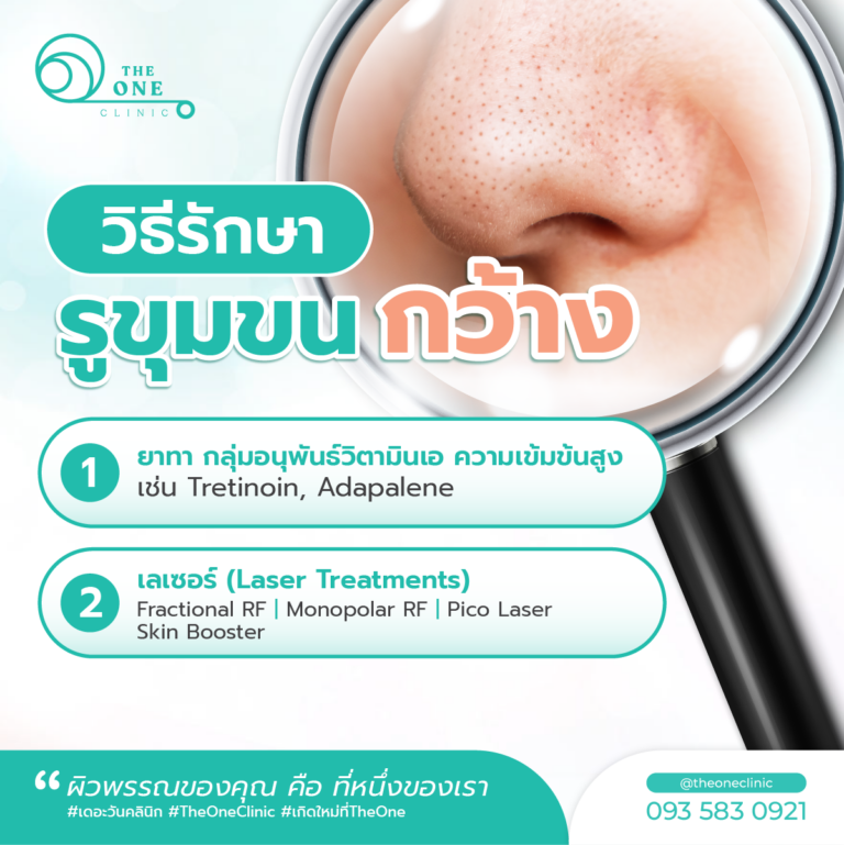 วิธีรักษารูขุมขนกว้าง