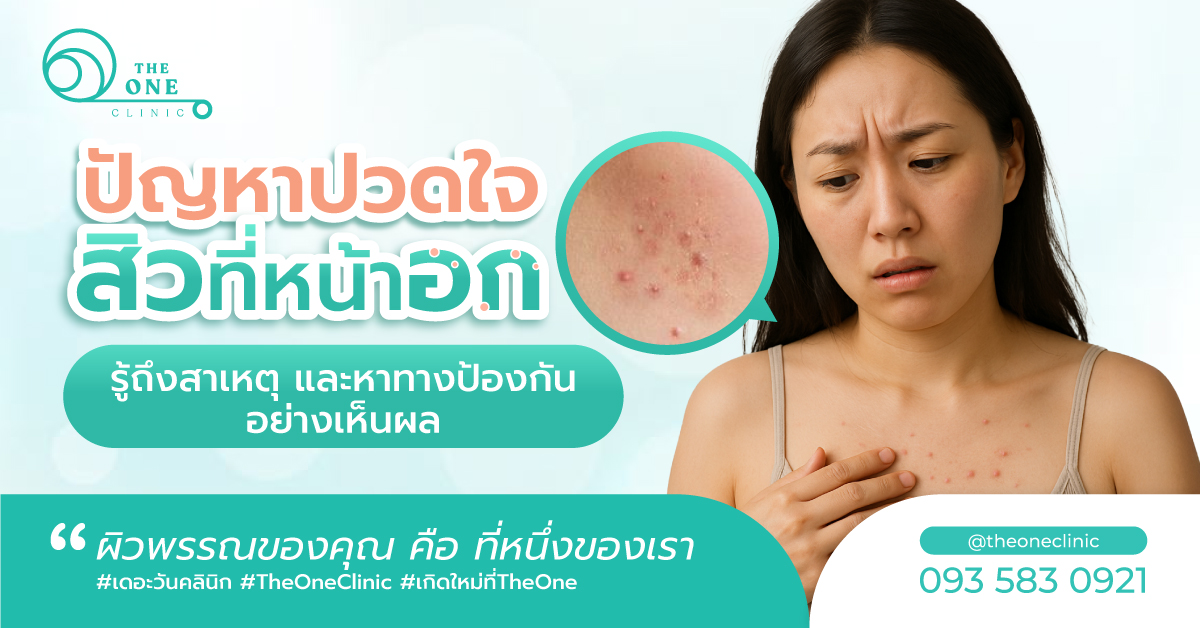 สิวที่อก