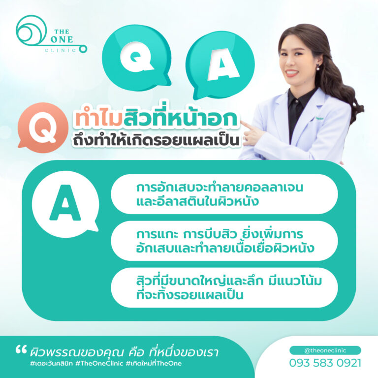 สิวที่อก แผลเป็น
