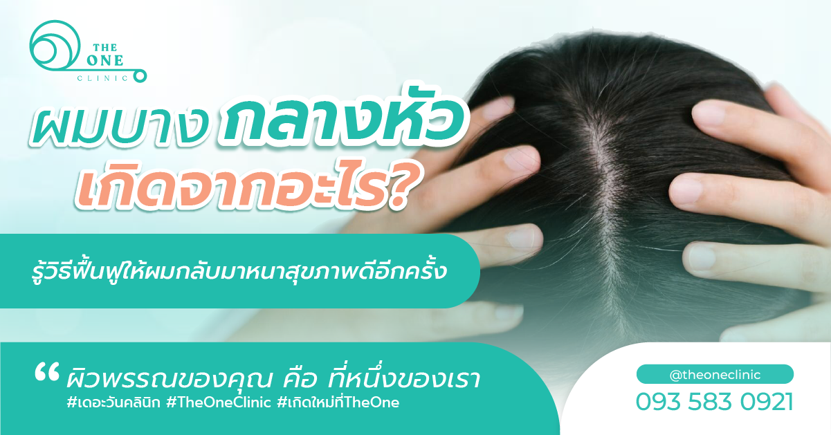 ผมบางกลางหัว