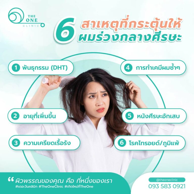 ผมบางกลางหัว สาเหตุ