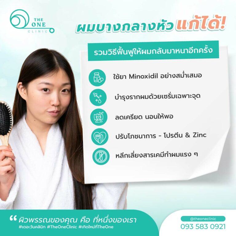 ผมบางกลางหัว แก้ได้