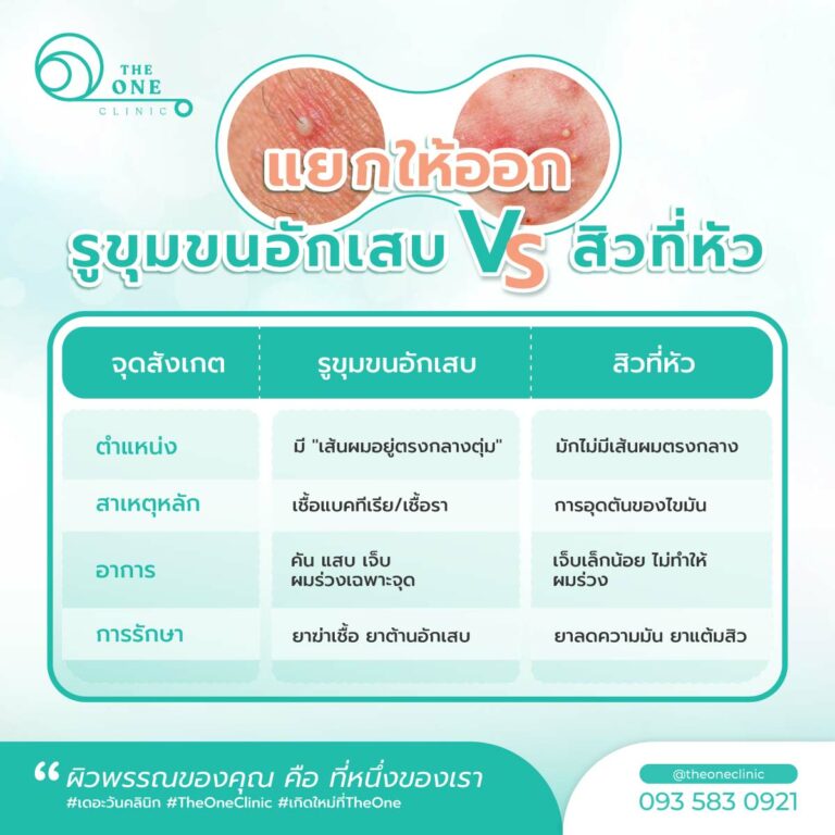รูขุมขนอักเสบ VS สิวที่หัว