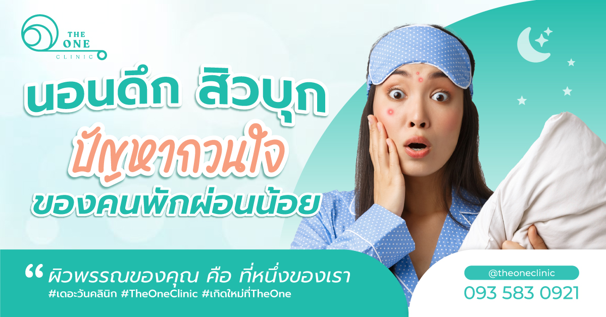 สิวนอนดึก