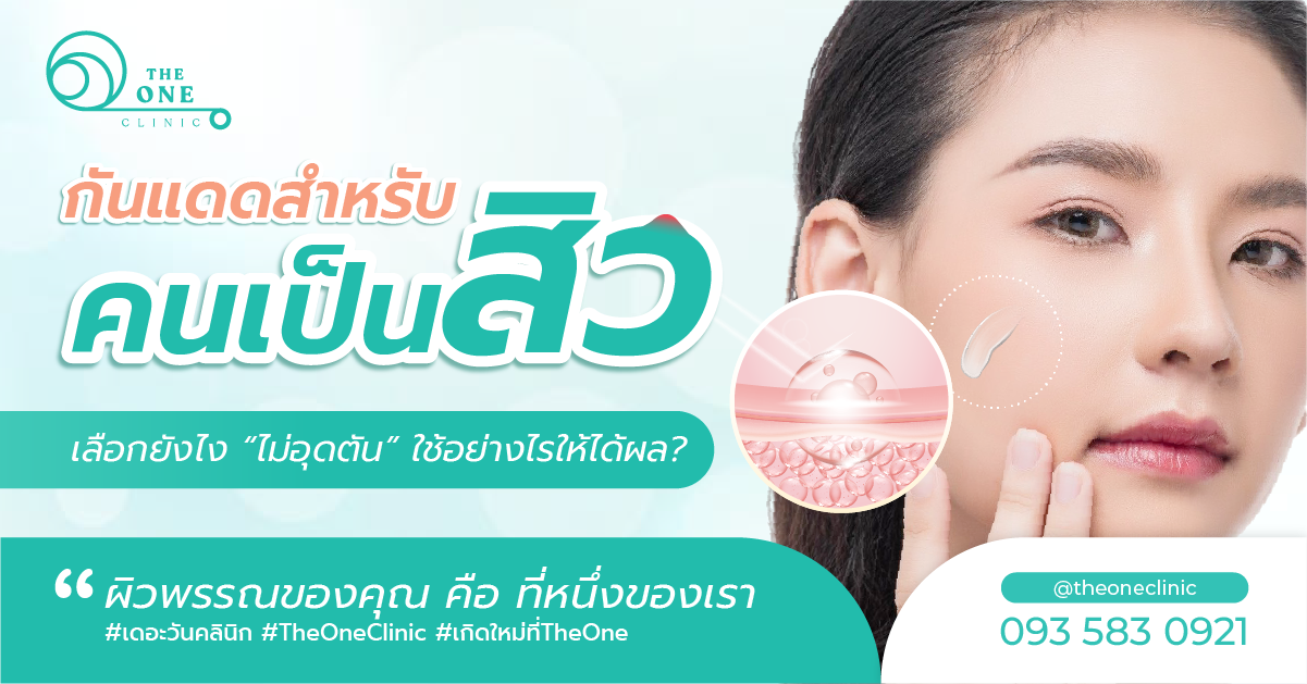 กันแดดคนเป็นสิว