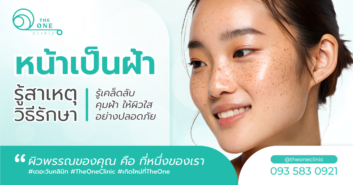 หน้าเป็นฝ้า