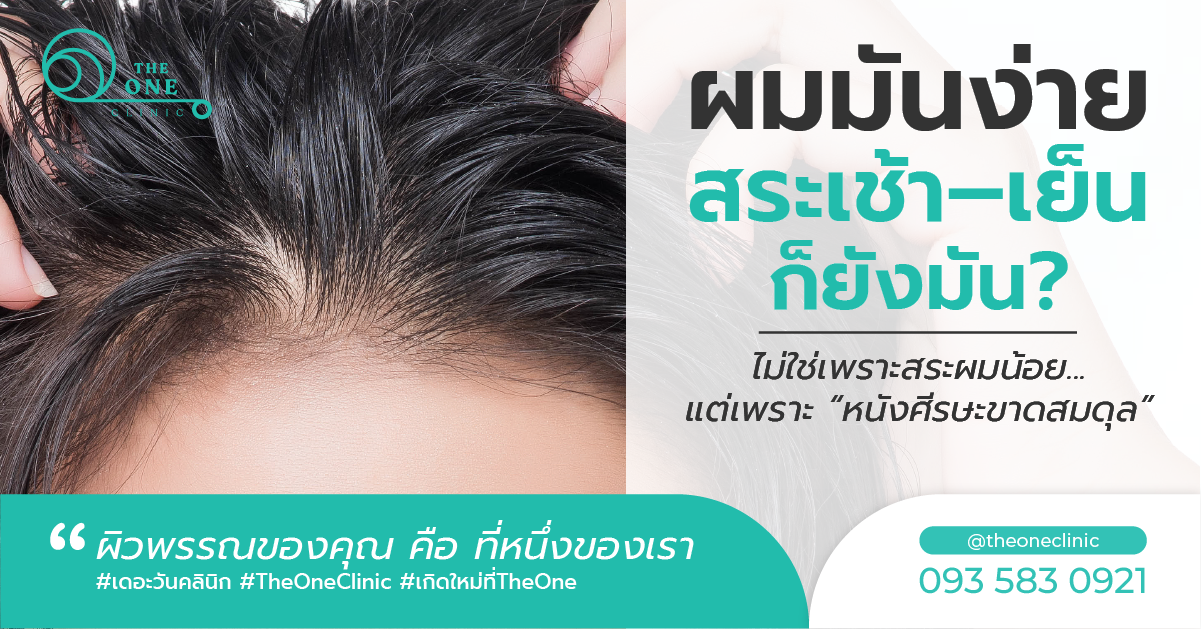 ผมมันง่าย