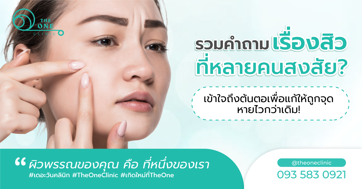 รวม FAQ สิว