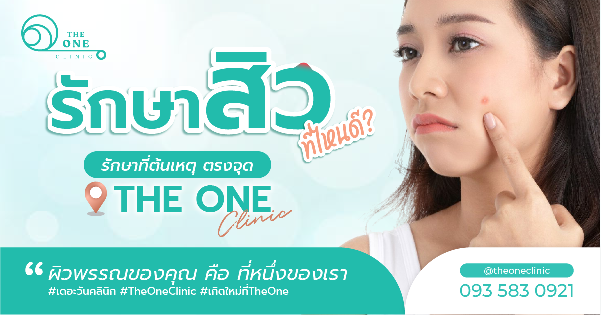 รักษาสิวที่ไหนดี
