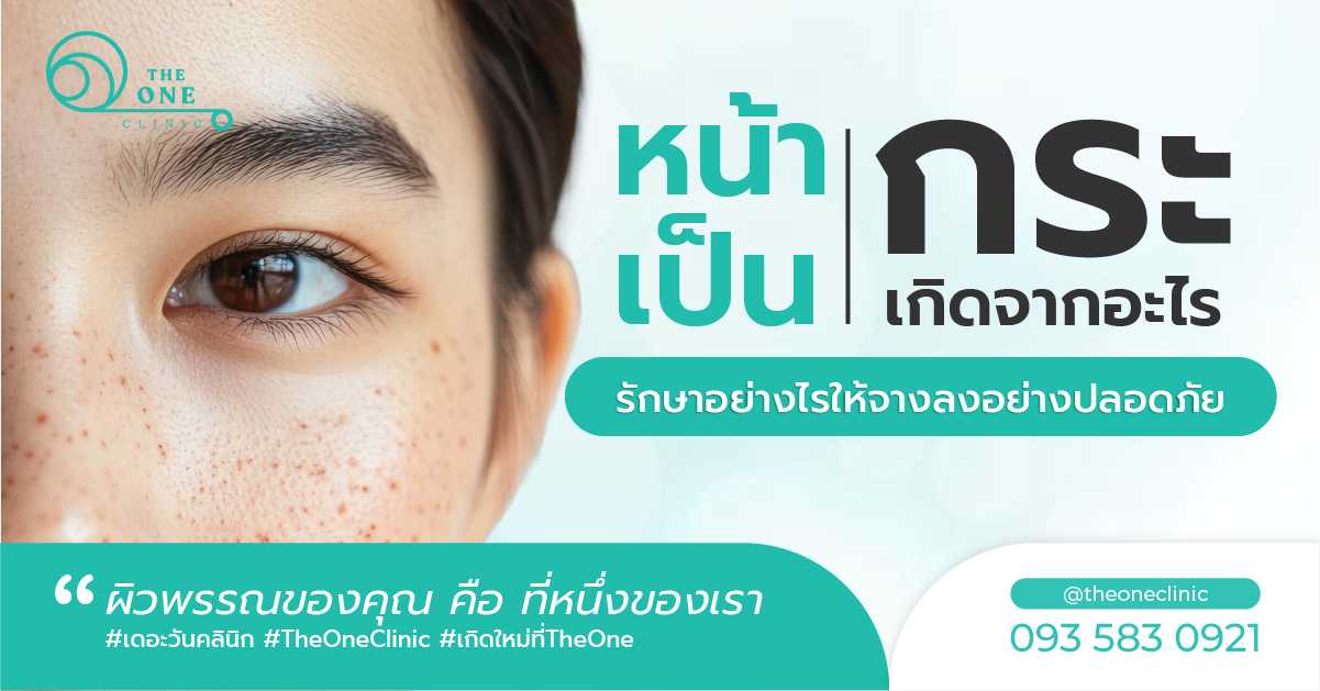 หน้าเป็นกระเกิดจากอะไร