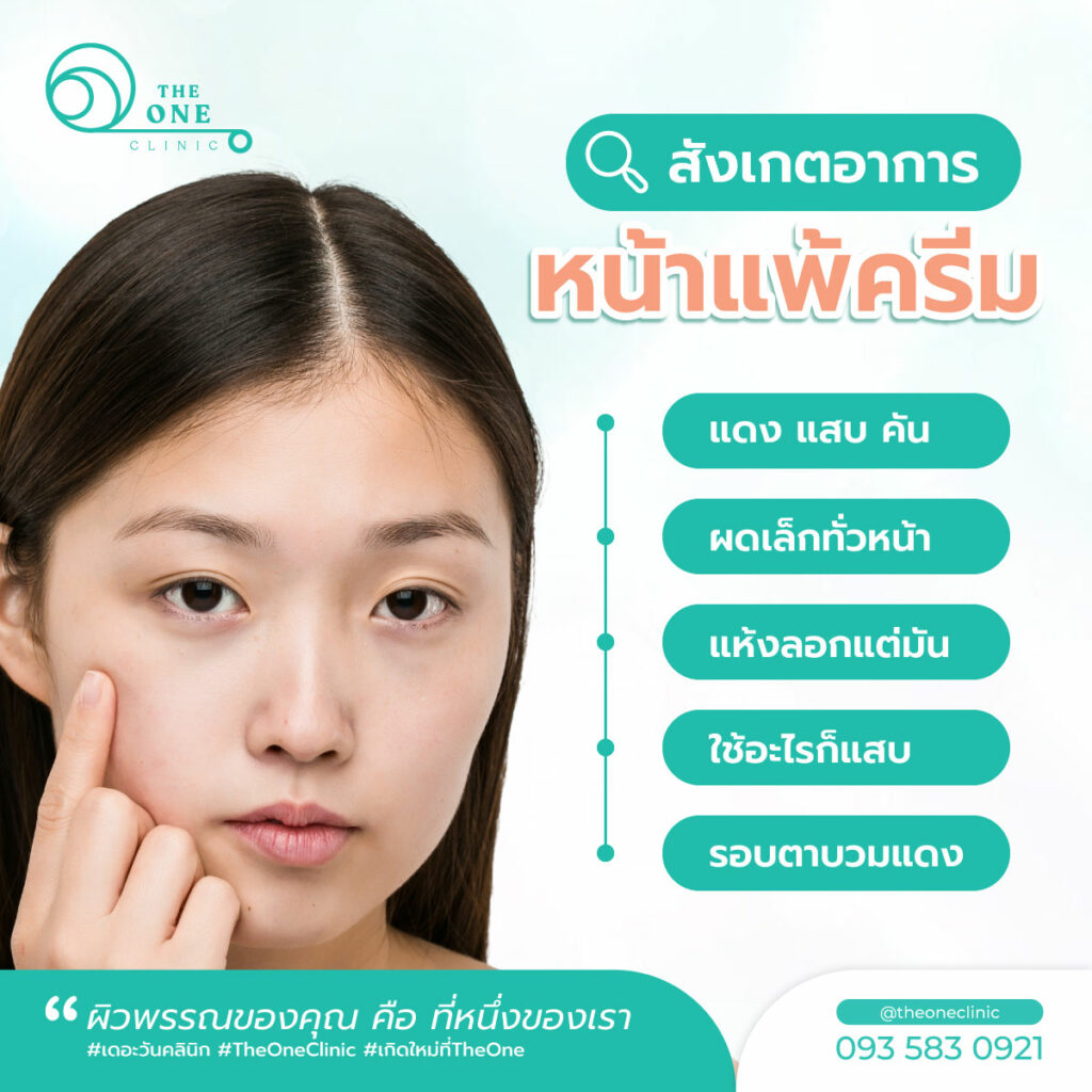 หน้าแพ้ครีม อาการ1