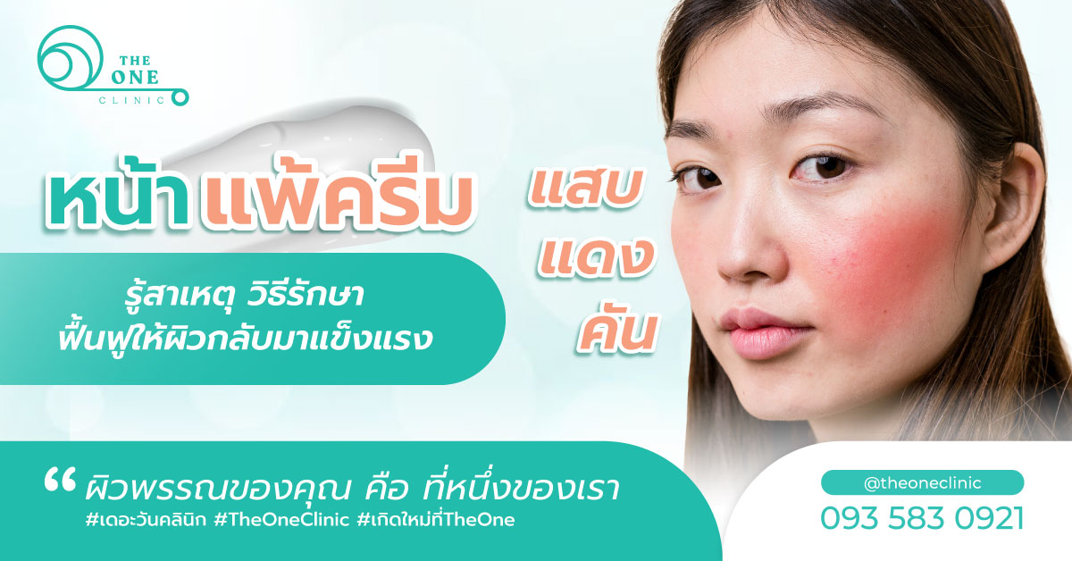 หน้าแพ้ครีม1