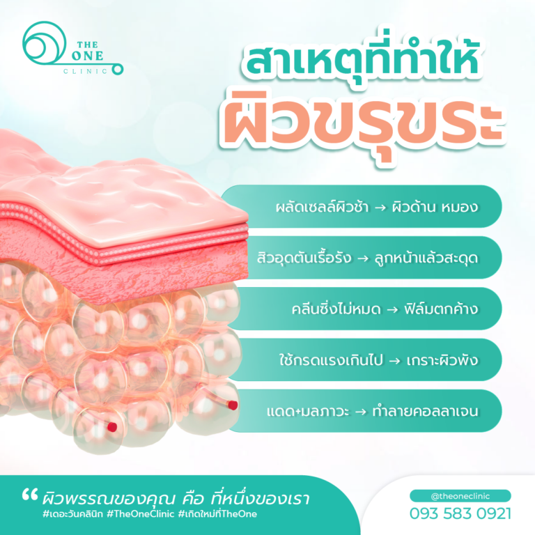 หน้าไม่เรียบเนียน สาเหตุ