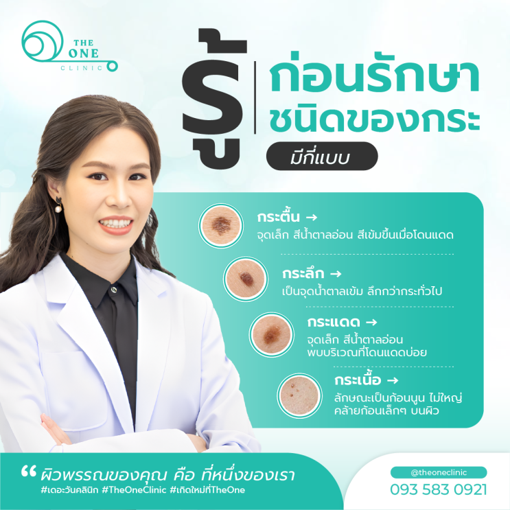 รู้ก่อนรักษาชนิดของกระ