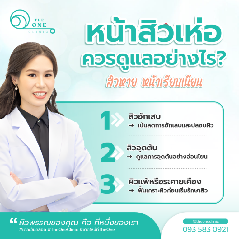 หน้าสิวเห่อ ดูแลอย่างไร