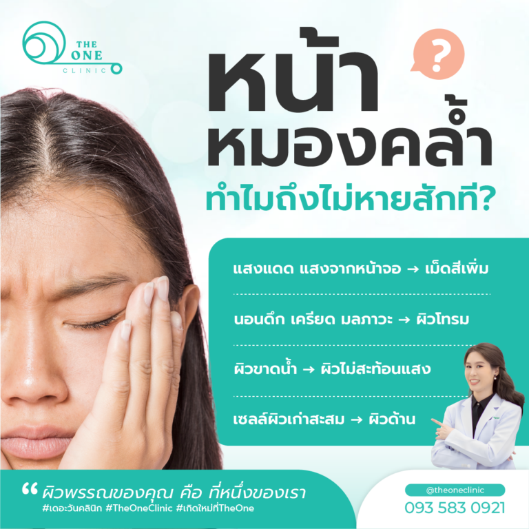 หน้าหมองคล้ำเกิดจาก