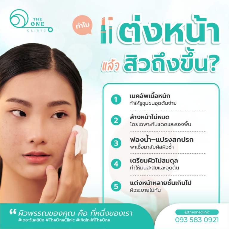 แต่งหน้าแล้วสิวขึ้น เกิดจาก