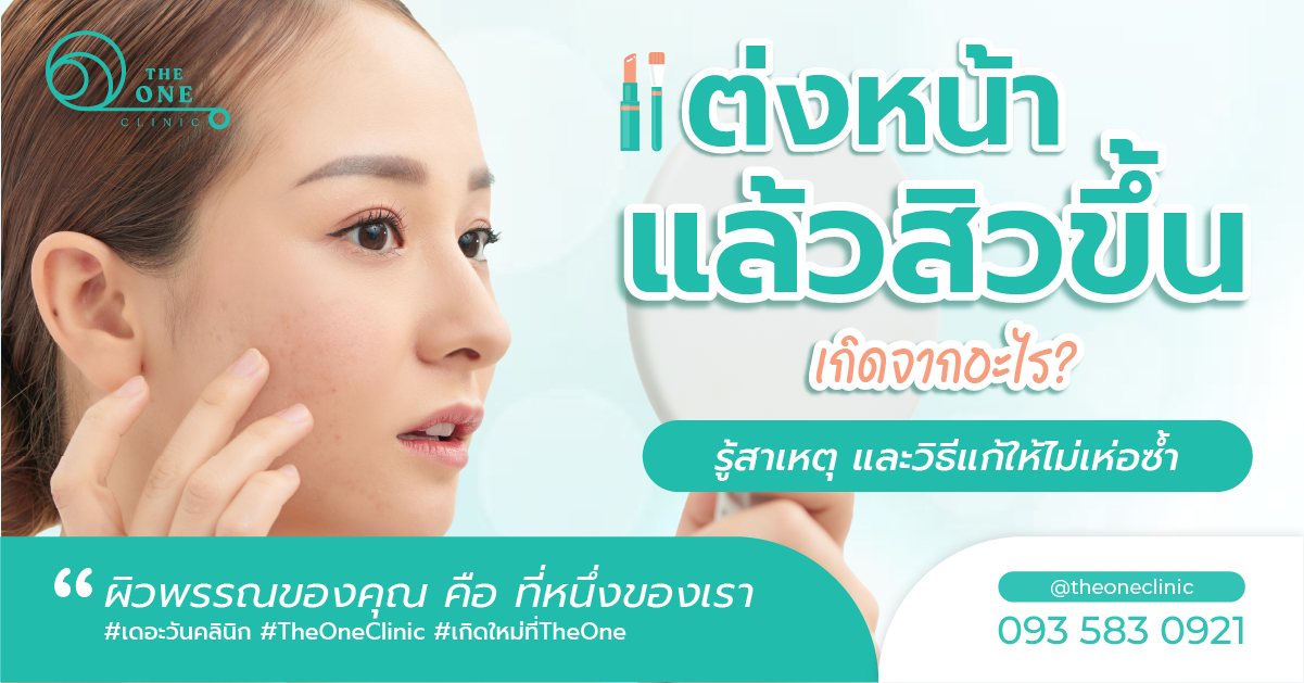 แต่งหน้าแล้วสิวขึ้น