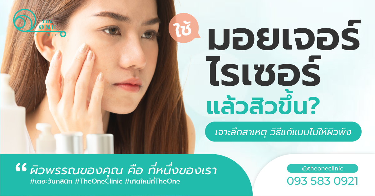 ใช้มอยเจอร์ไรเซอร์แล้วสิวขึ้น