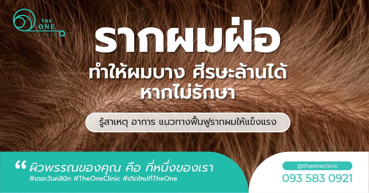 รากผมฝ่อ