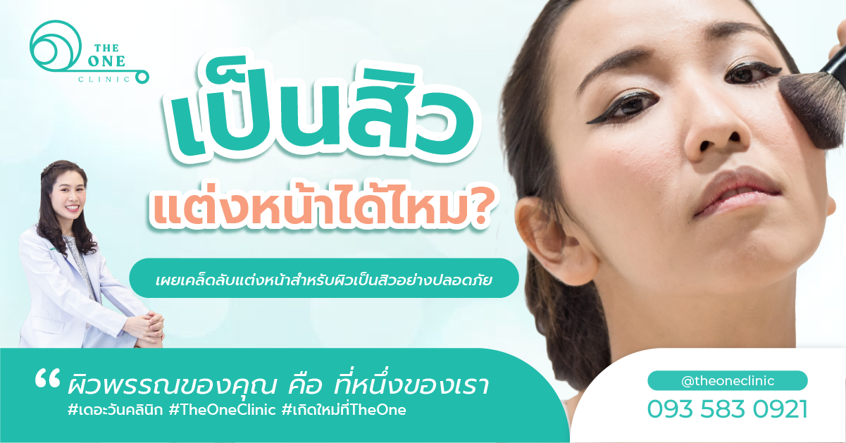 เป็นสิวแต่งหน้าได้ไหม