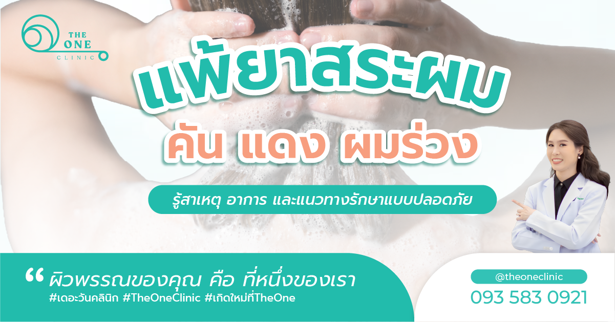 แพ้ยาสระผม