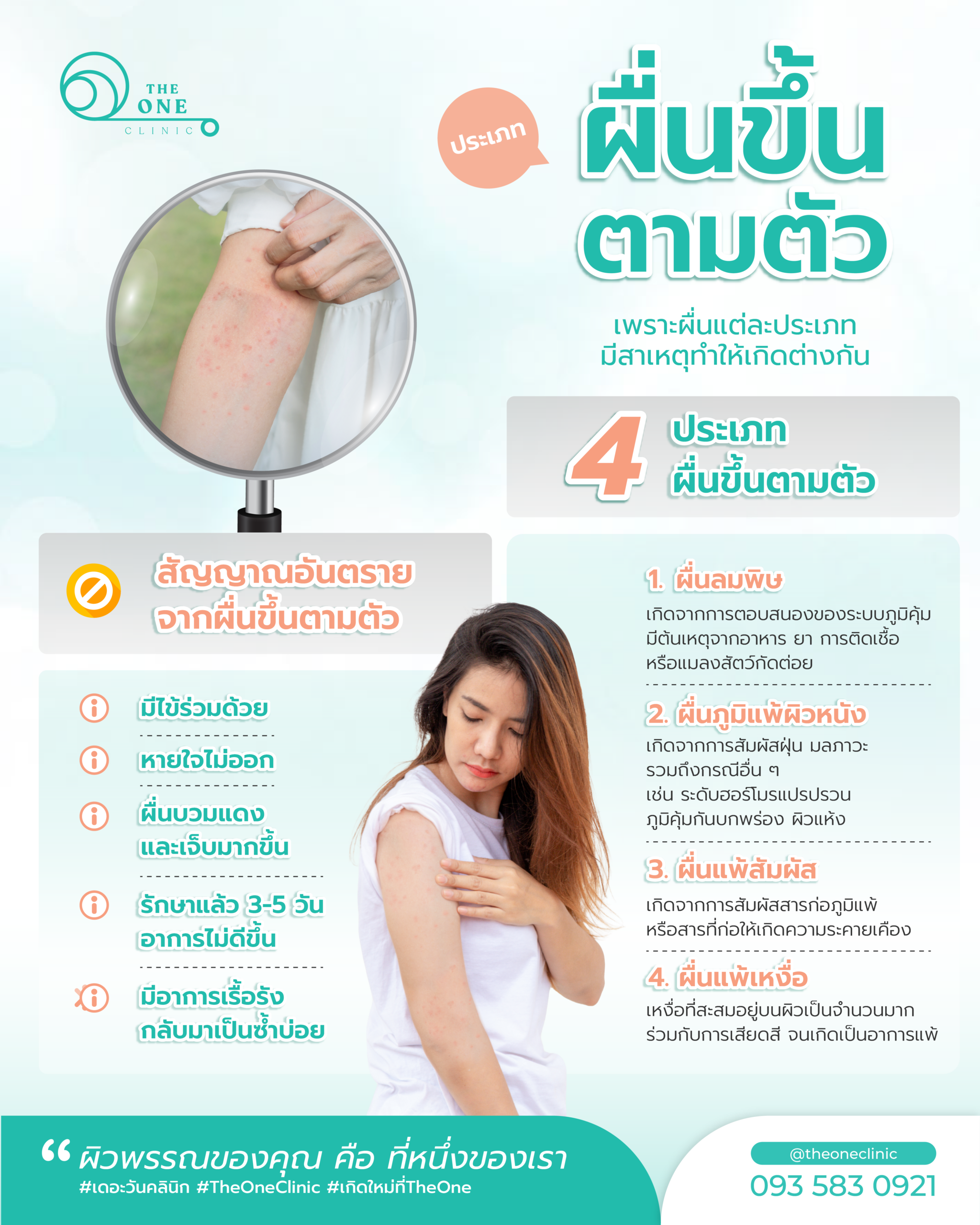 ผื่นขึ้นตามตัว Info