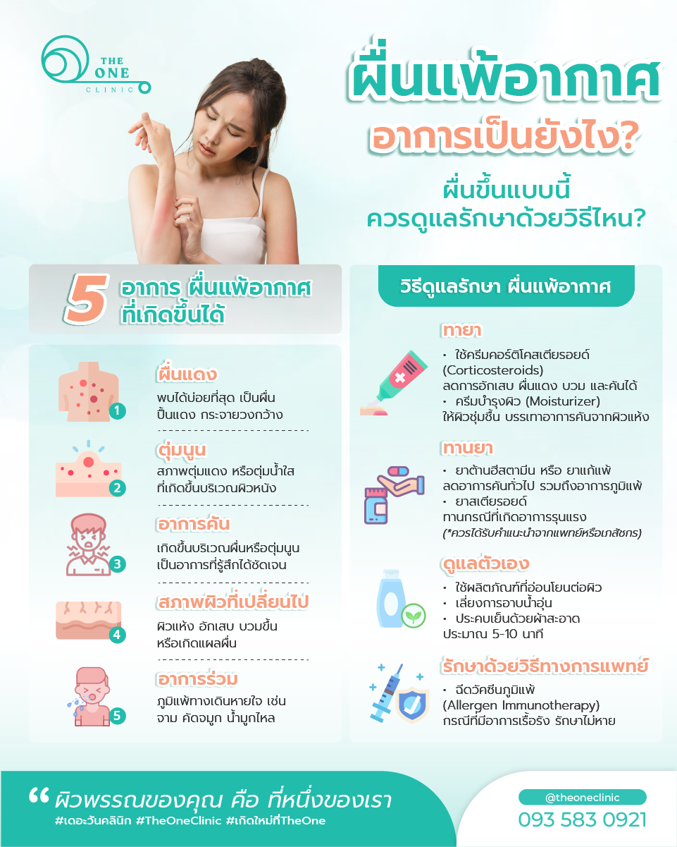 ผื่นแพ้อากาศ Info