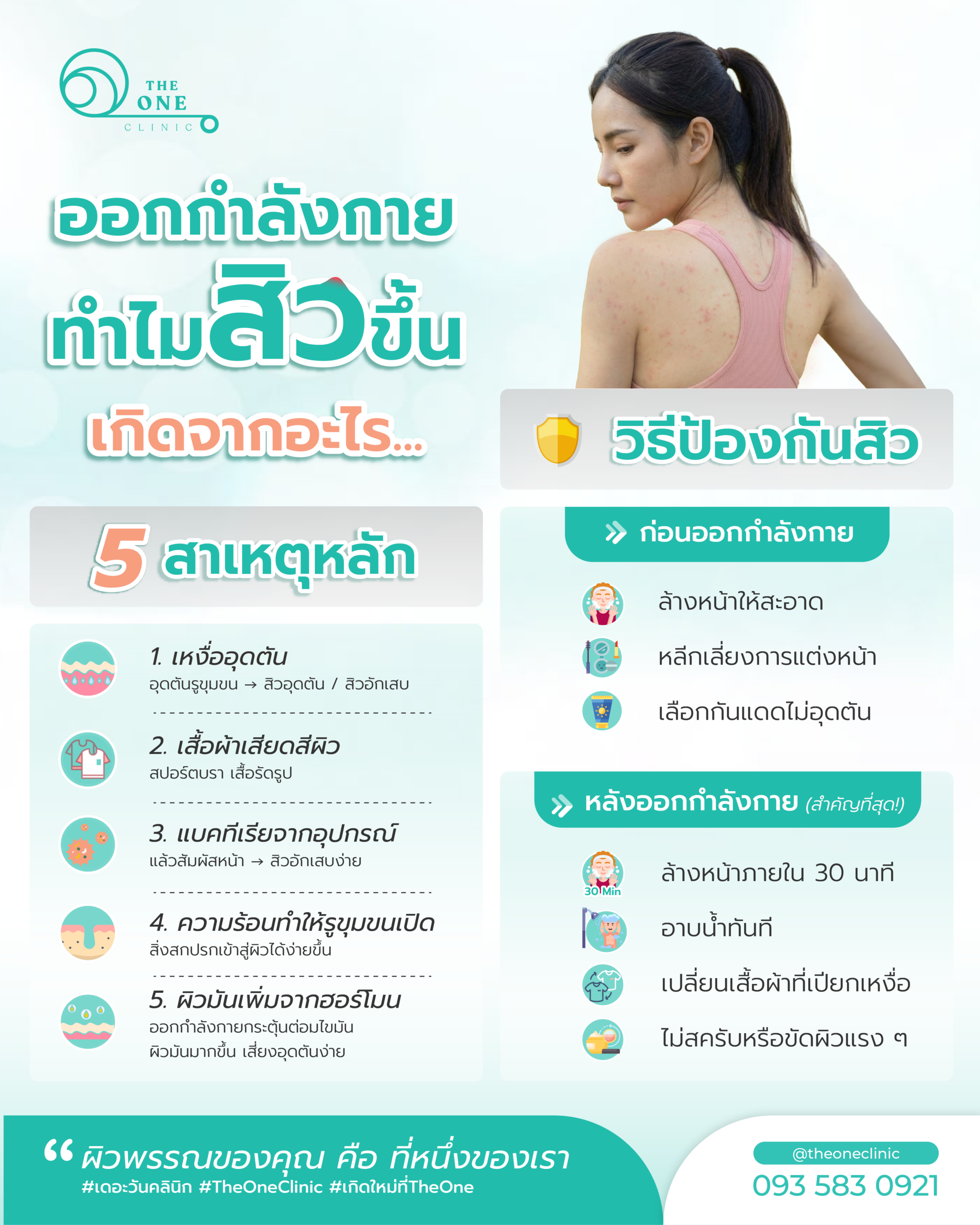 ออกกำลังกาย สิวขึ้น สาเหตุ