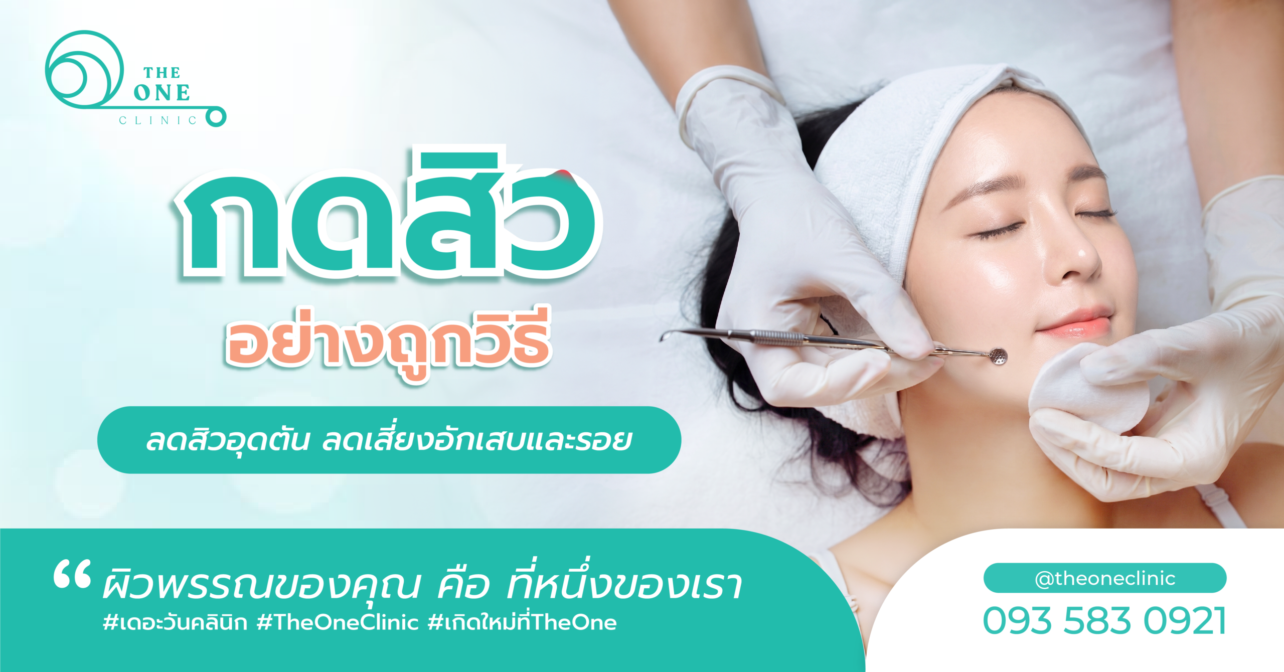 กดสิวอย่างถูกวิธี ทำเมื่อไหร่ดี และดูแลผิวอย่างไรให้ไม่ทิ้งรอย