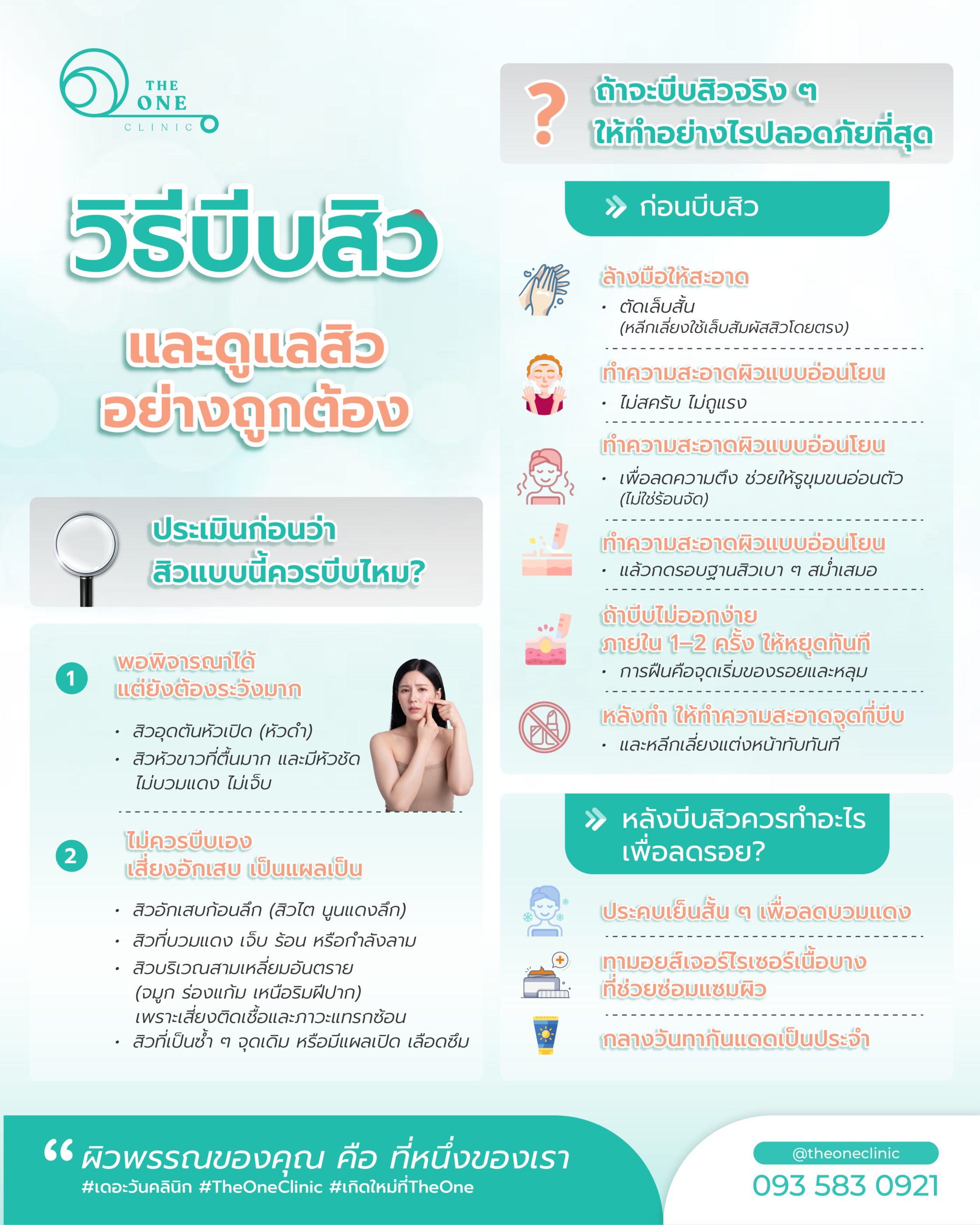 วิธีบีบสิวและดูแลสิวอย่างถูกต้อง